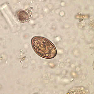 Case198_B.jpg