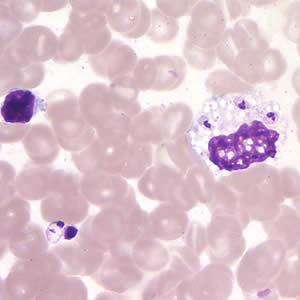 Case200_B.jpg