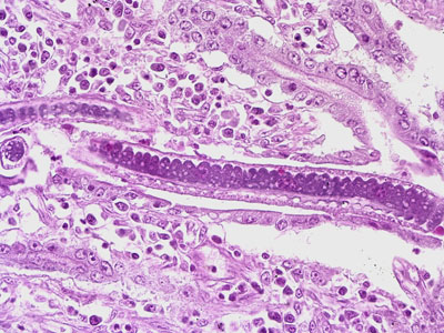 Case201_B.jpg