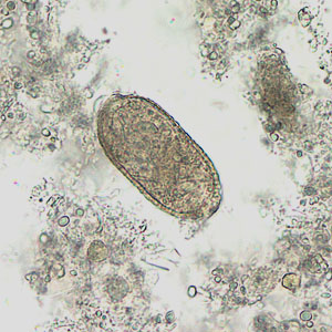 Case201_D.jpg
