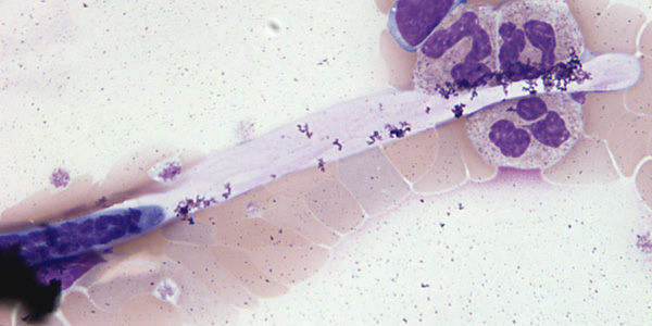 Case206_C.jpg