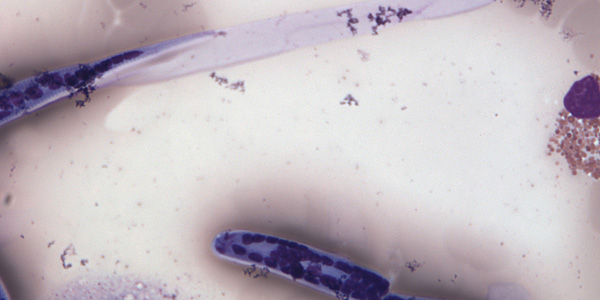 Case206_D.jpg