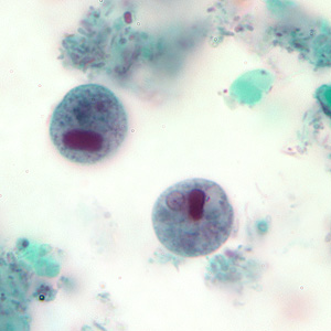 Case207_B.jpg