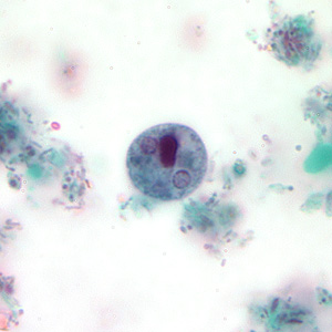 Case207_C.jpg