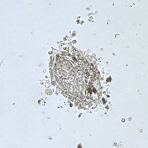 Case208_A.jpg Case208