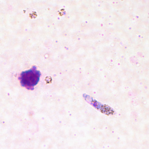 Case211_E.jpg Case211