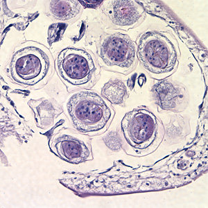 Case212_D.jpg Case212