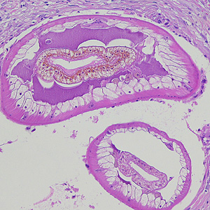 Case215_B.jpg Case215