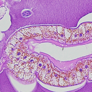 Case215_C.jpg Case215