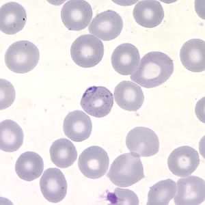 Case217_B.jpg