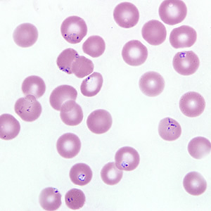 Case218_B.jpg