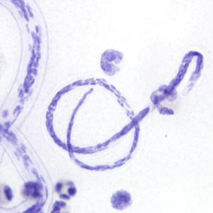 Case222_B.jpg