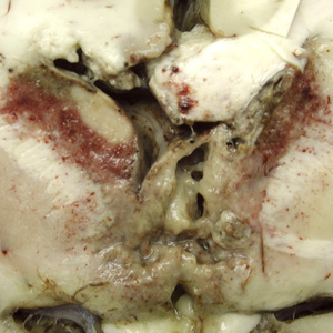 Case223_B.jpg