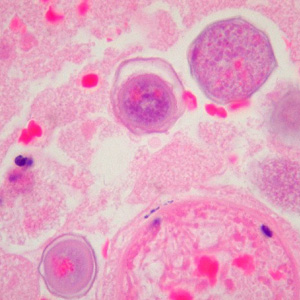 Case223_C.jpg