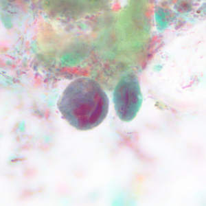 Case228_B.jpg