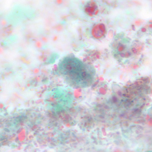 Case228_D.jpg