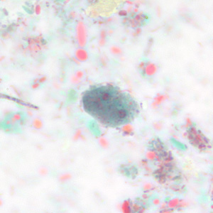 Case228_E.jpg