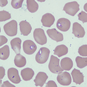 Case229_B.jpg