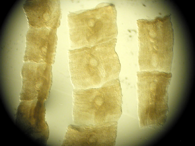 Case232_B.jpg