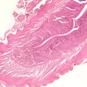 Case236_B.jpg