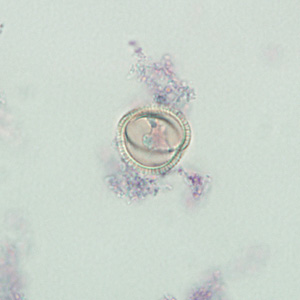 Case237_D.jpg