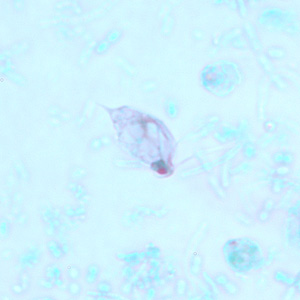 Case239_A.jpg