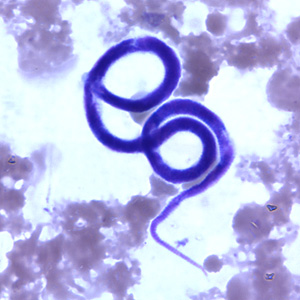 Case240_D.jpg
