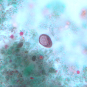 Case243_C.jpg