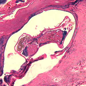 Case244_C.jpg