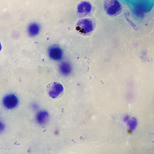 Case245_A.jpg