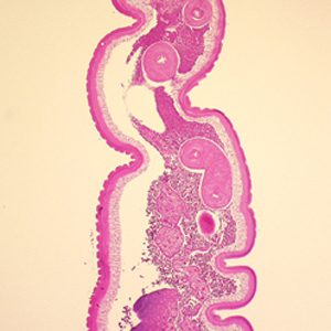Case248_B.jpg