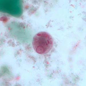 Case251_D.jpg