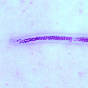 Case252_B.jpg