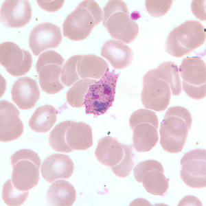 Case255_B.jpg
