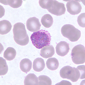 Case255_D.jpg