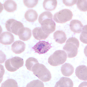 Case255_E.jpg
