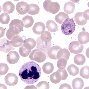 Case255_F.jpg