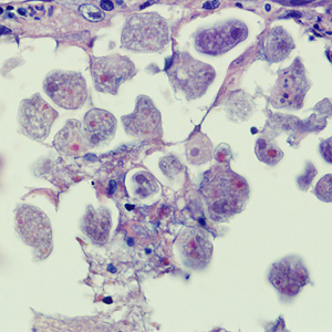 Case258_B.jpg