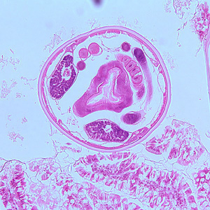 Case259_B.jpg