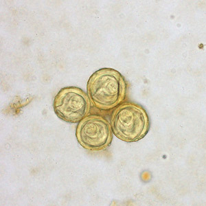Case261_B.jpg