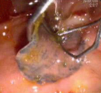 Case263_B.jpg