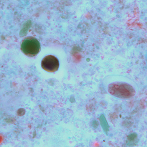 Case264_A.jpg