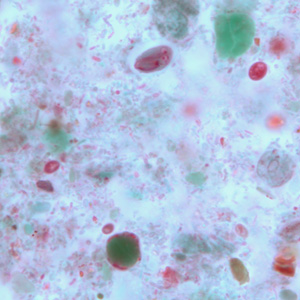 Case264_B.jpg