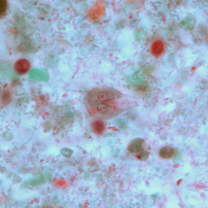 Case264_C.jpg