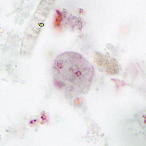 Case265_B.jpg