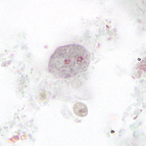 Case265_D.jpg