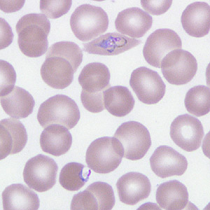 Case266_F.jpg