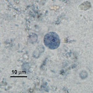 Case276_F.jpg