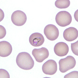Case277_B.jpg