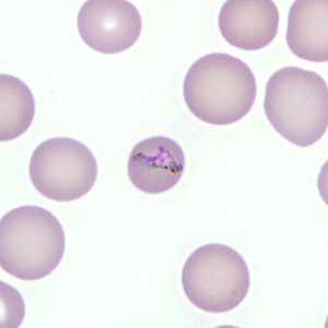 Case277_C.jpg